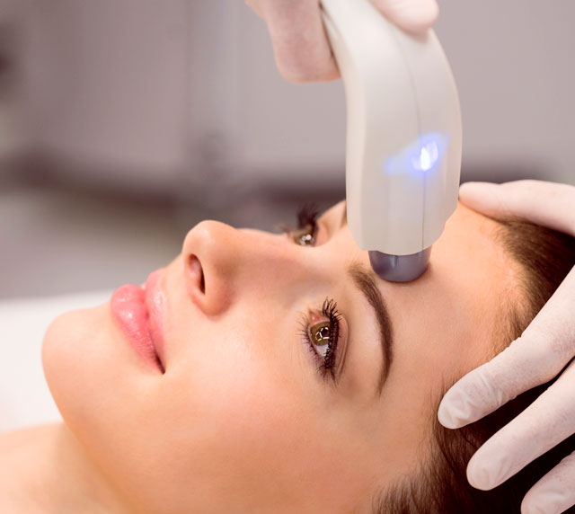 luz pulsada intensa - IPL